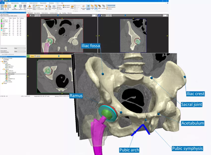 sw-scanip-hip-segmentation-greybg